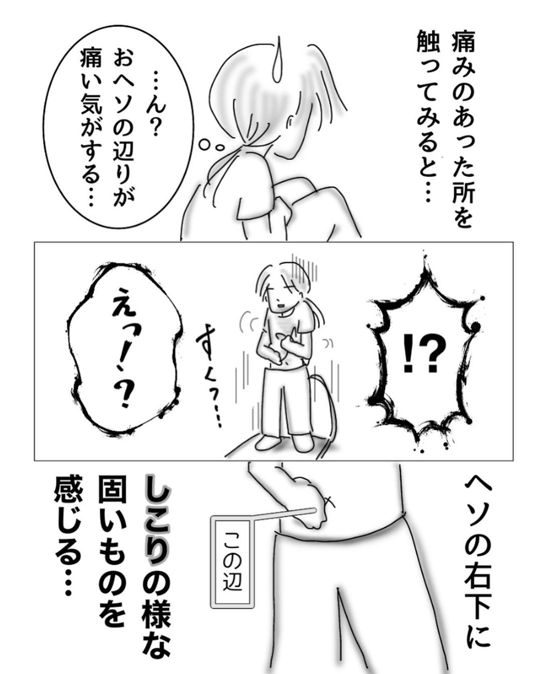 漫画 おへそ が突然痛んで 触ったらしこり 激臭の物体も出てきて病院へ 衝撃的で言葉が出ない オトナンサー