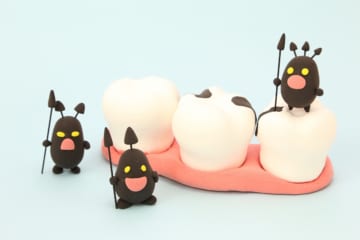 虫歯のできやすさの違いとは？