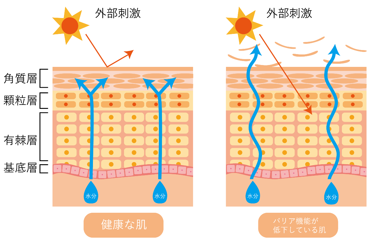 肌のバリアー機能が低下すると、紫外線などの外部刺激に弱くなり、水分が蒸発して乾燥しやすくなってしまう ※有棘層(ゆうきょくそう)には強力な免疫細胞が存在し、炎症を抑制する役割を担う