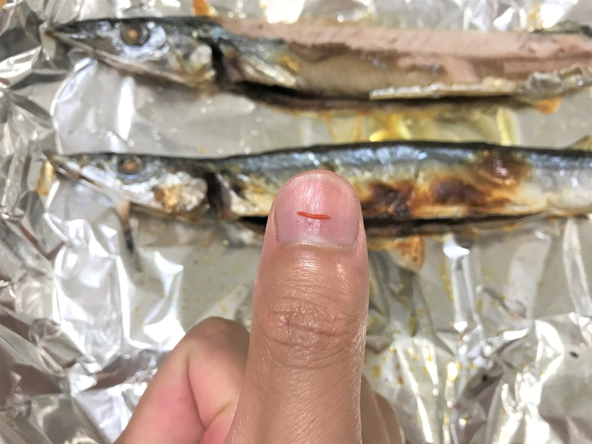 サンマに付着していた寄生虫の「ラジノリンクス」(早武忠利さん提供)