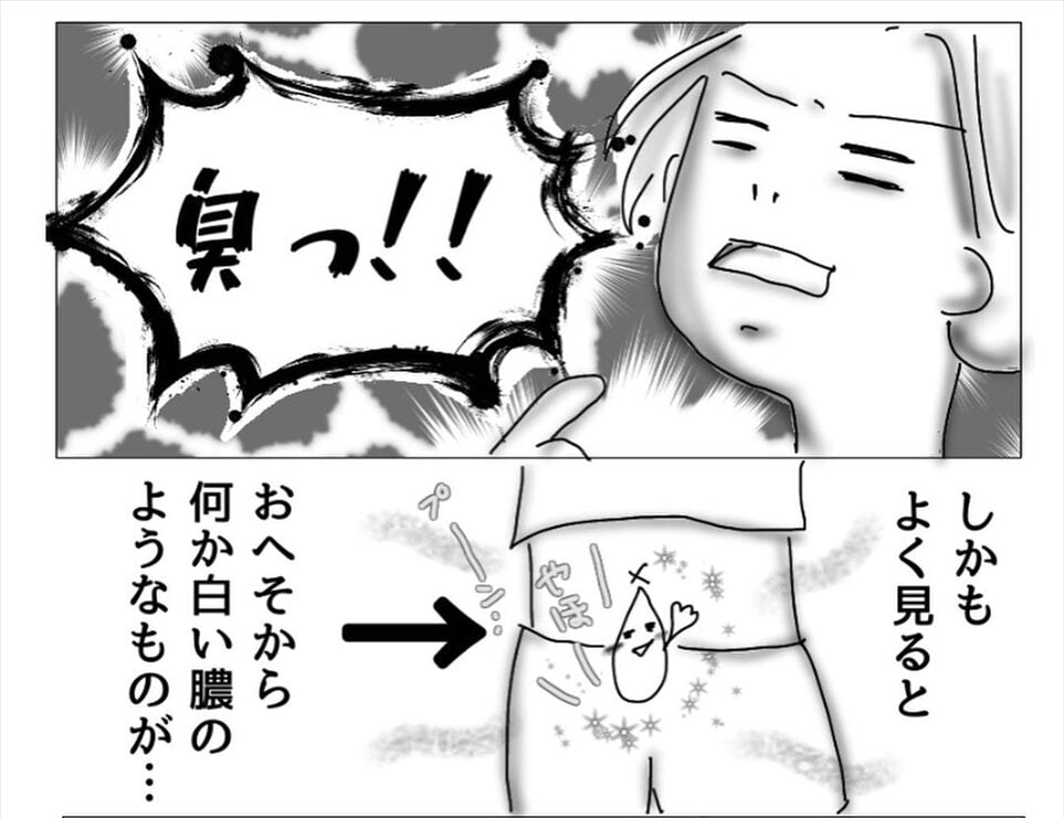 漫画「おヘソに異変が起きた話」のカット（オムニウッチーさん提供）