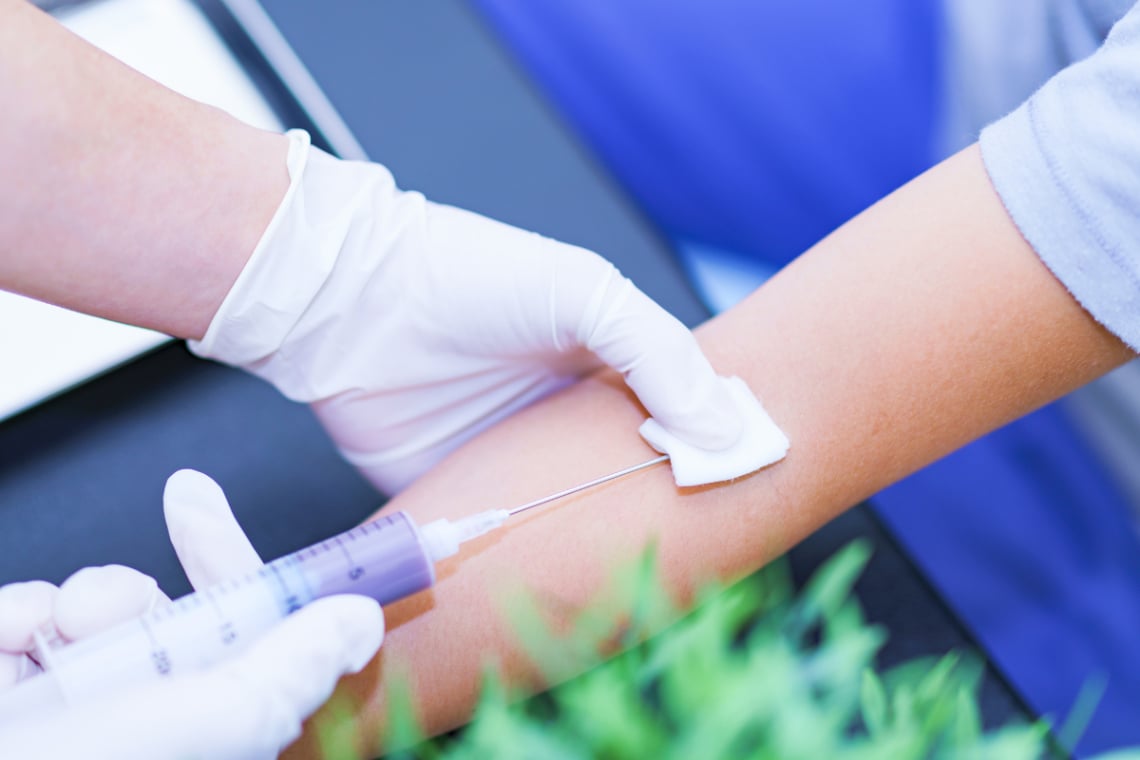 採血をする腕は右と左どっち？
