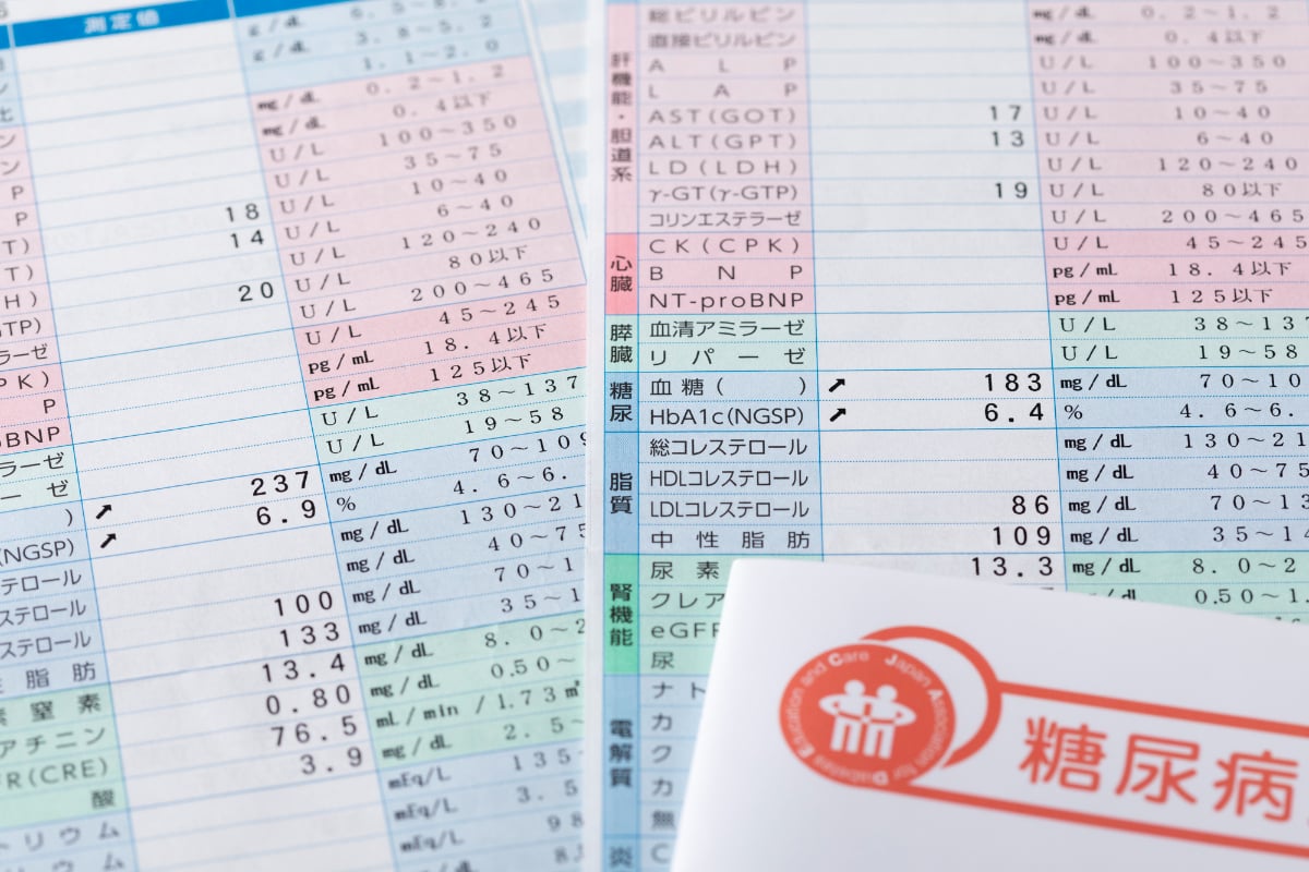 「糖代謝検査」でBと判定されたときの注意点は？（画像はイメージ）