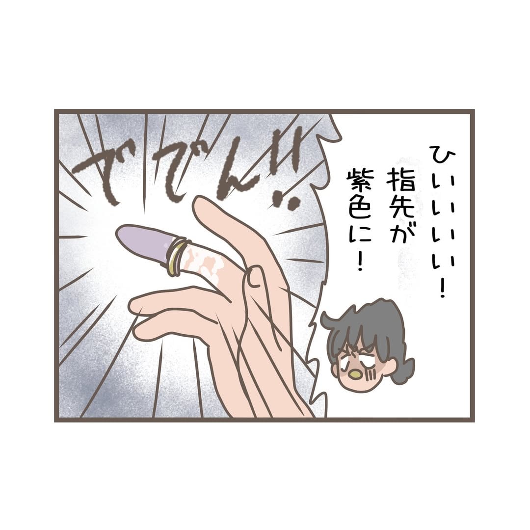 漫画「指輪が抜けなくなった話」のカット（コケ川さん提供）