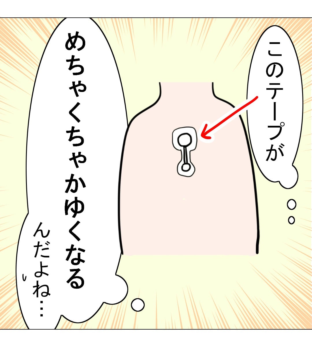 漫画「1週間ホルター心電図レポ漫画」のカット（萩原さとこさん提供）