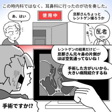 漫画「鼻中隔湾曲症で手術をした話」のカット（yamamiiさん提供）