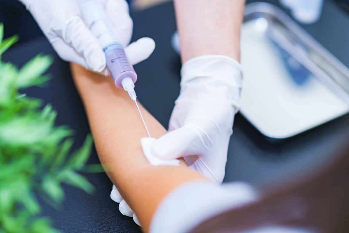 血液の色が黒いのは異常？（画像はイメージ）